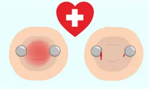 Rote Brustwarzen mit Piercings, eine entzündet, die andere blutet. Ein rotes Herz mit weißem Kreuz darüber. Vorsicht beim Stillen mit Nippelpiercing.