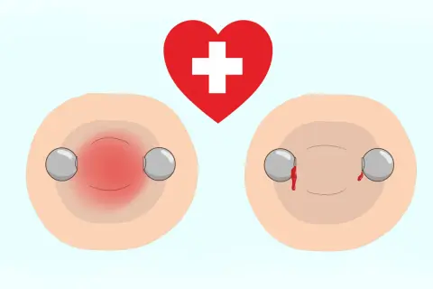 Rote Brustwarzen mit Piercings, eine entzündet, die andere blutet. Ein rotes Herz mit weißem Kreuz darüber. Vorsicht beim Stillen mit Nippelpiercing.