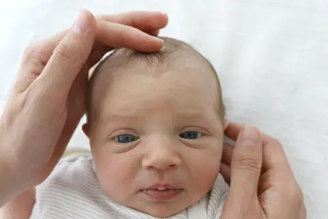 Sanft berühren die Hände eines Elternteils das Köpfchen eines Babys. Die Fontanelle ist leicht eingefallen, ein Zeichen für mögliche Dehydrierung.