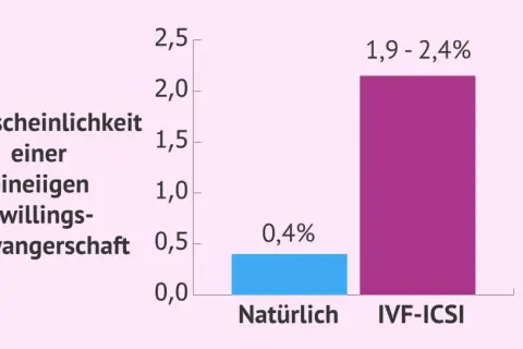 Balkendiagramm zeigt: Wahrscheinlichkeit einer eineiigen Zwillingsschwangerschaft ist natürlich 0,4%, bei IVF-ICSI 1,9-2,4%.