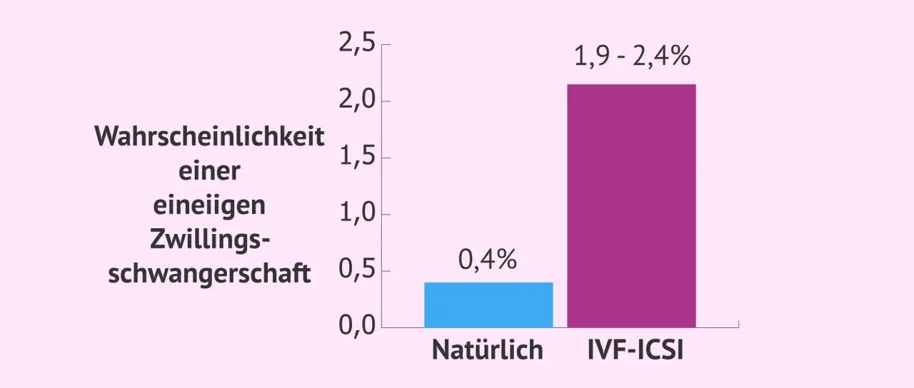 Balkendiagramm zeigt: Wahrscheinlichkeit einer eineiigen Zwillingsschwangerschaft ist natürlich 0,4%, bei IVF-ICSI 1,9-2,4%.