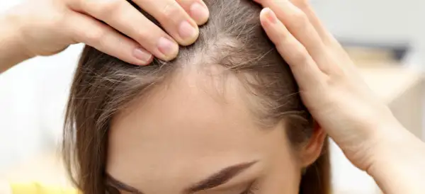 Frauenhände prüfen die Kopfhaut, wo feine baby haare wachsen.